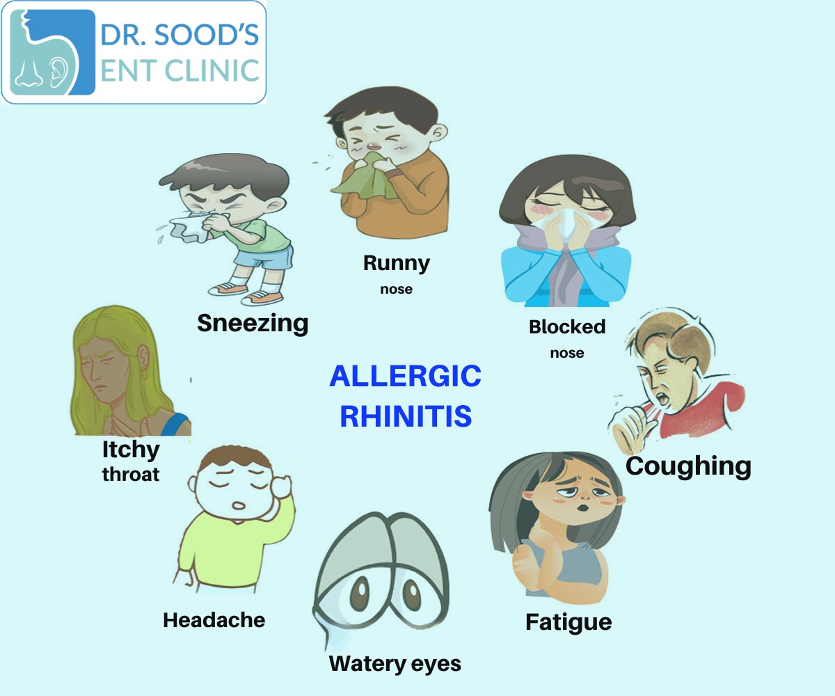 Nasal Allergy